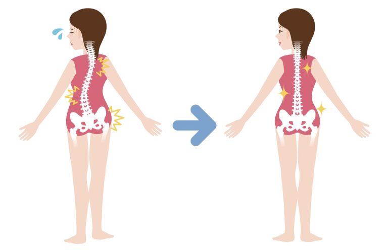 Chiropractic,Before,After,Image,,From,Bad,Posture,To,Good,Posture,